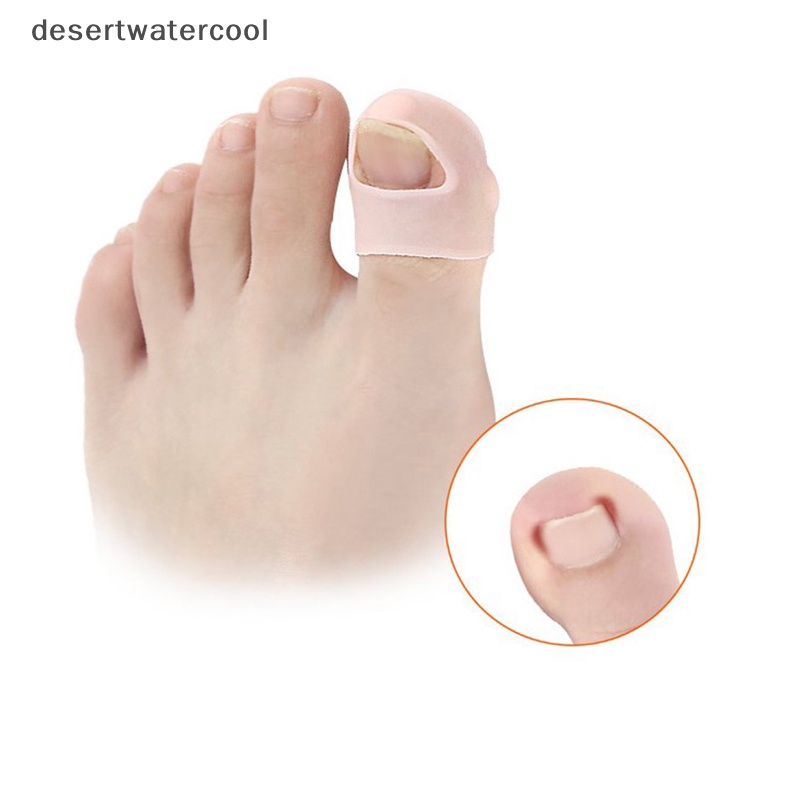 Deid 1pasang Silikon Alat Koreksi Kuku Kaki Ke Dalam Invisible Toe Nail Treatment Martijn