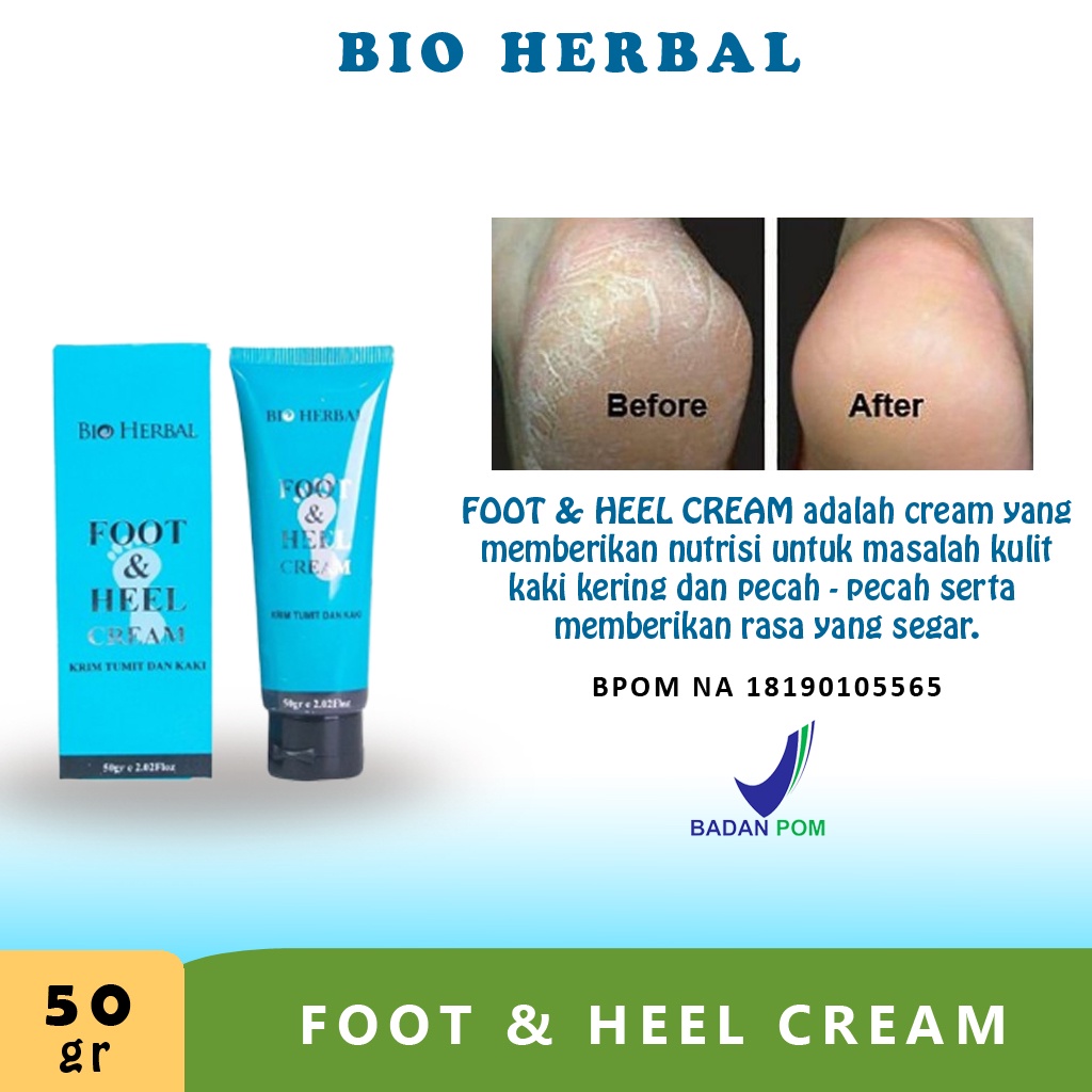 Obat Kaki Pecah Dan Kering Foot Cream Penghalus Tumit Kaki Cream Kaki Pecah2 B10A