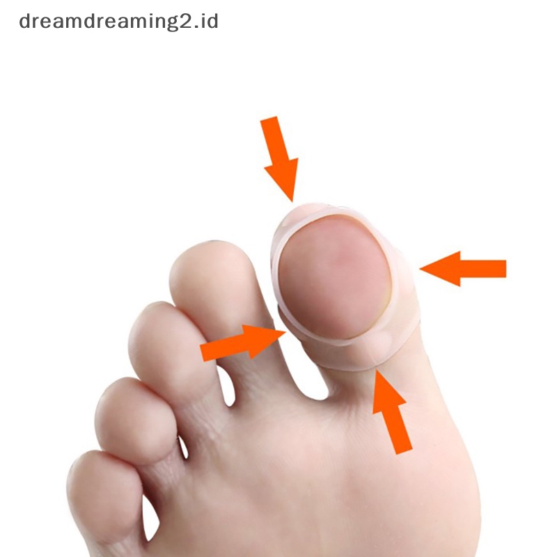 (drea) 1pasang Silikon Alat Koreksi Kuku Kaki Ke Dalam Invisible Toe Nail Treatment//