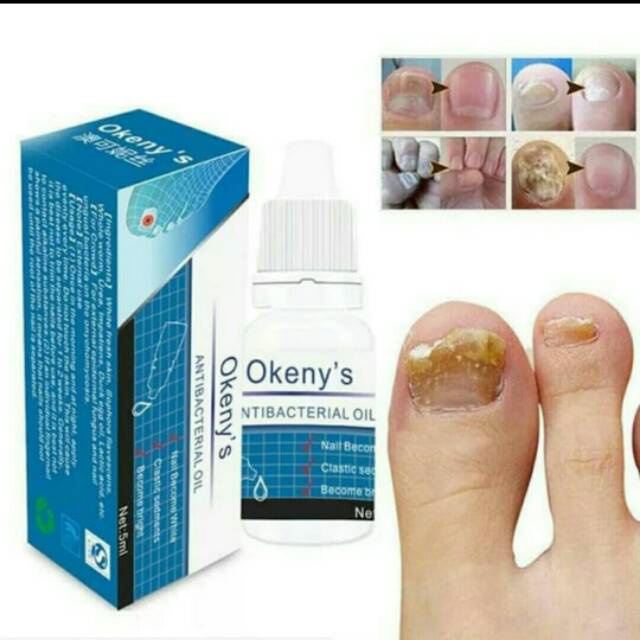 OBAT CANTENGAN DAN JAMUR KUKU XOD