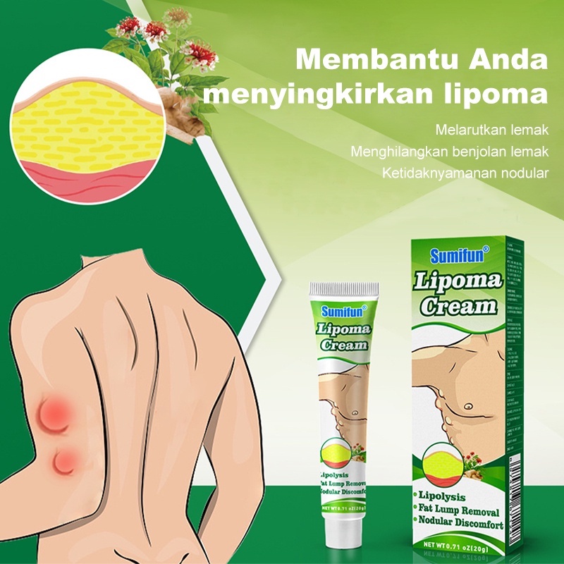 Sumifun Obat Benjolan Lipoma Salep Lipoma Herbal/Fibroid/Benjolan Subkutan/Leher Benjolan/Punggung Pundak Benjolan/Kista Ganglion Benjolan/Kelenjar Tiroid Limfoma Limpoma Kelenjar-20g Lipoma Remover Treatment Ointment