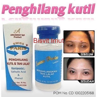 SWISS PARIS Salep Kutilat Salep Penghilang Kutil dan Tahi Lalat Perman