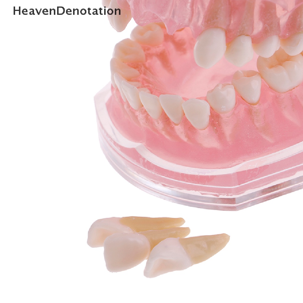 [HeavenDenotation] Plastik typodont orthodontic model Standar4004Dengan 28gigi Lepas HDV