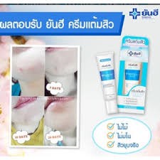 YANHEE YAN HEE ACNE CREAM | THE BEST ACNE CREAM FROM THAILAND