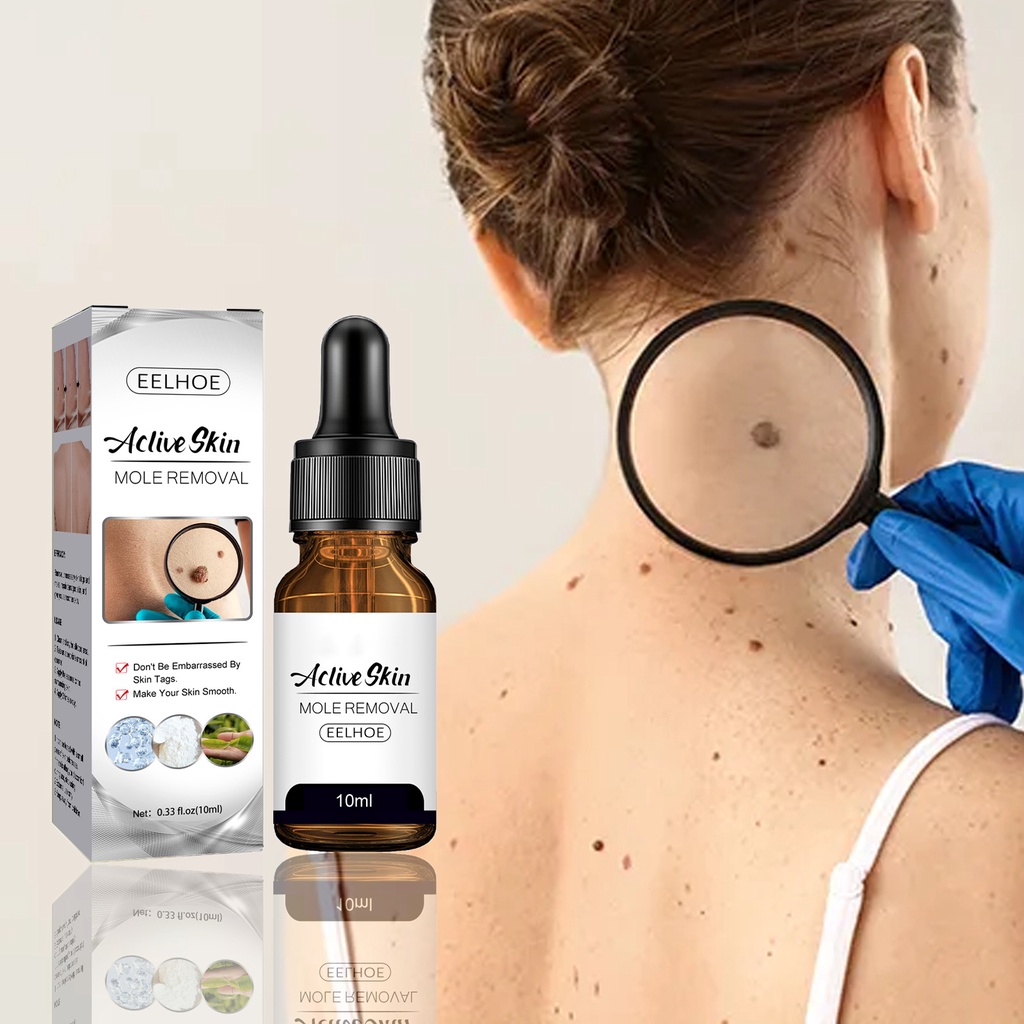 Obat Kutil Paling Ampuh Obat Penghilang Kutil Obat Penghilang Tahi Lalat Permanen Obat Kutil Kelamin Untuk di leher / wajah / tangan 10ml