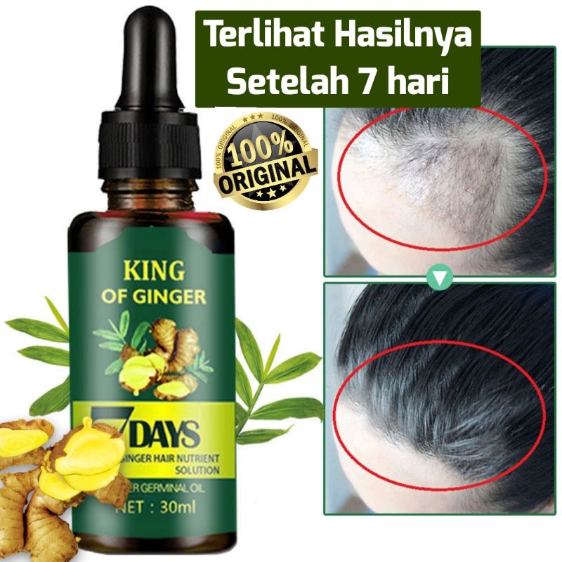 Clothes of Skin 7 Days Ginger Germinal Oil Minyak penumbuh dan perawatan Rambut Botak 30ml Penumbuh Rambut Botak