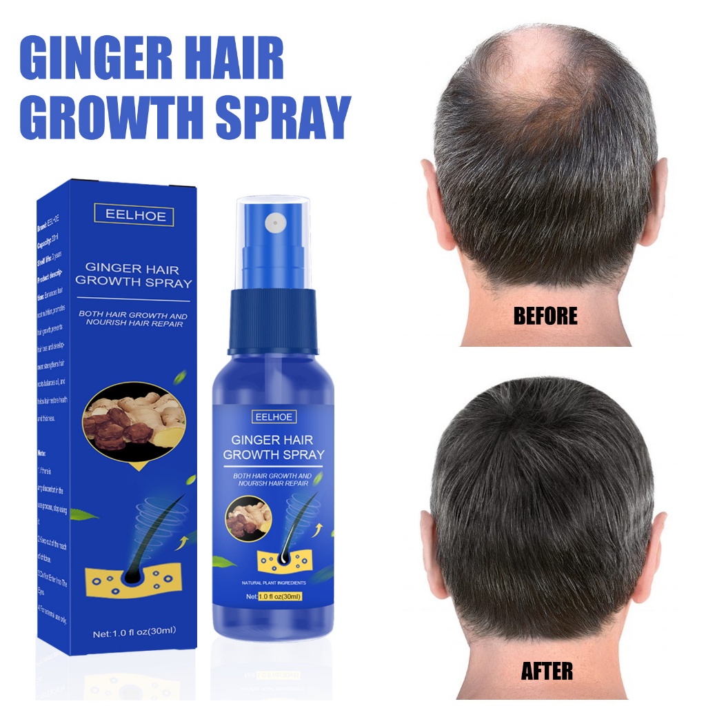 (UMU SUPPLIER) SPRAY PENUMBUH RAMBUT BOTAK, TIPIS DAN RONTOK SUPER CEPAT ORIGINAL AMPUH GINGER HAIR GROWTH EELHOE