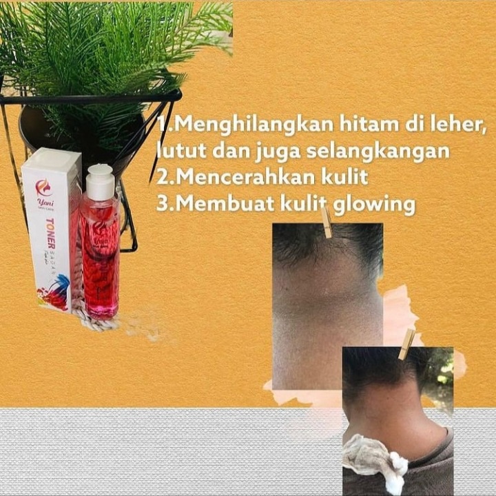 TONER BADAN YONI SKINCARE ORIGINAL 100% BPOM / PENGHILANG DAKI