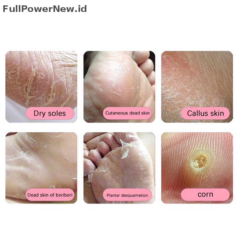 Power Stainless Steel Pedicure Foot File Kulit Mati Keras Callus Remover Penggiling Kaki ID