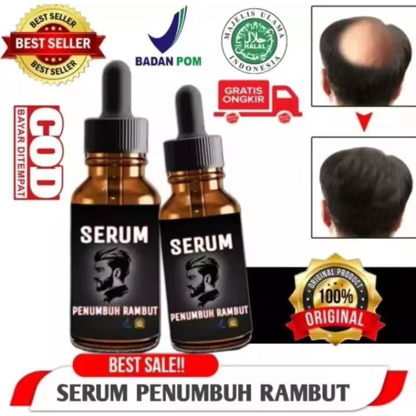 PNUMBUH RAMBUT-SERUM PENUMBUH - Penumbuh Rambut Secara Cepat / Obat Penumbuh Rambut Botak Super Cepa