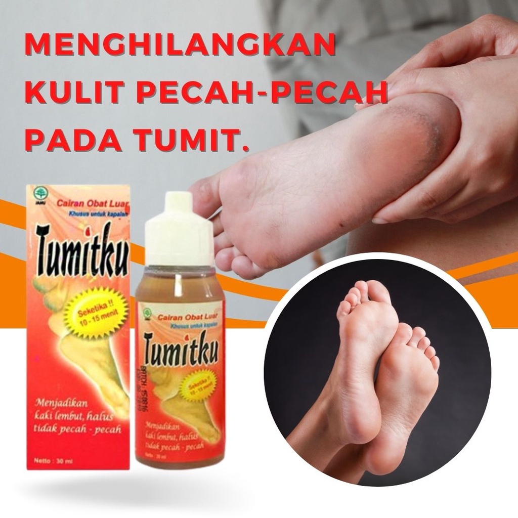 (HARGA GROSIR) TERLARIS TUMITKU Obat Kaki Pecah Original BPOM Solusi Kaki Pecah-pecah Dan Kapalan ukuran 30 ml cod