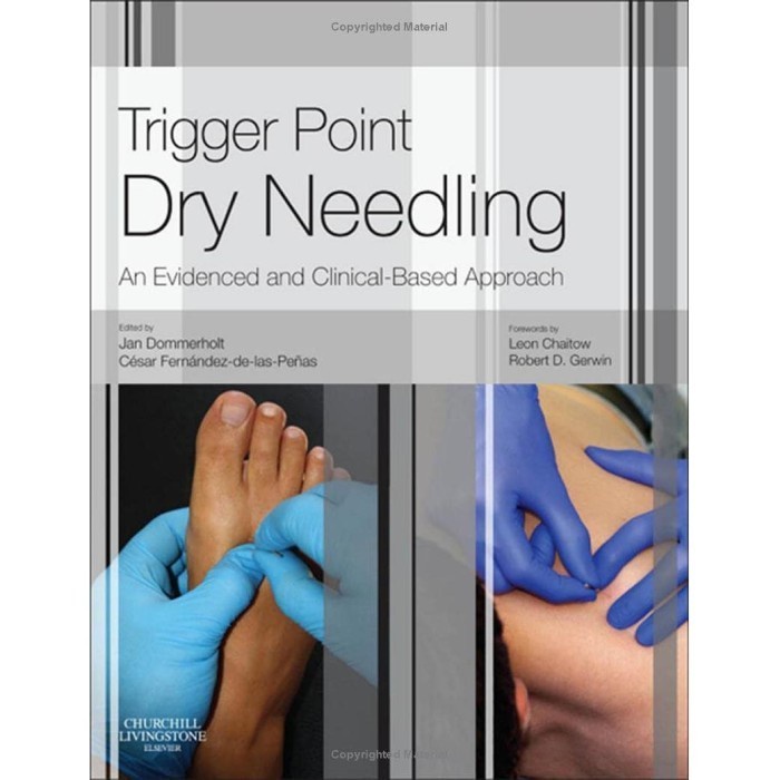 

(Isi Warna) Trigger Point Dry Needling An Evidence and Clinical-Based