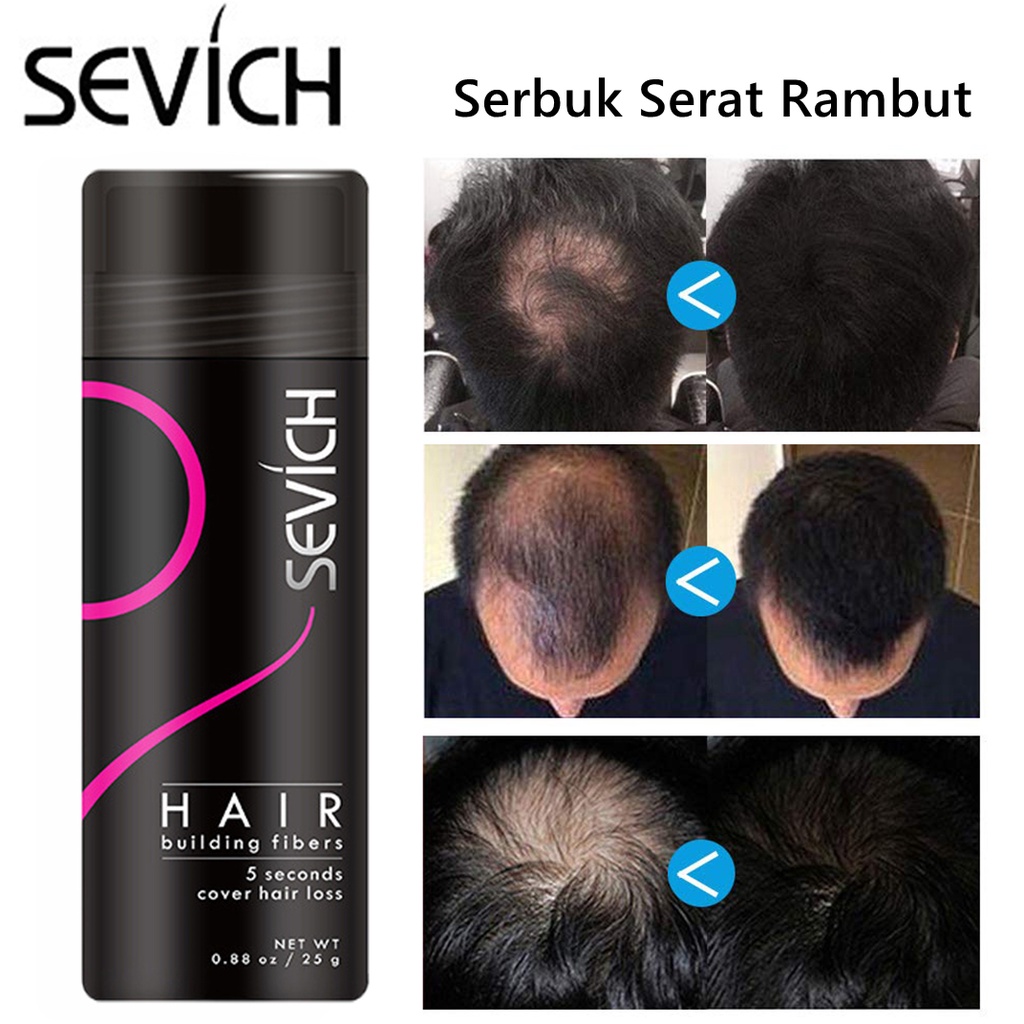 Sevich Hair Building Fibers - Bubuk Fiber Penebal Rambut (Hitam/Dark Brown) 25Gram Fibers Menutup Rambut Yang Botak Atau Tipis - Natural Fiber Powder Material (Tidak Hair Growth )