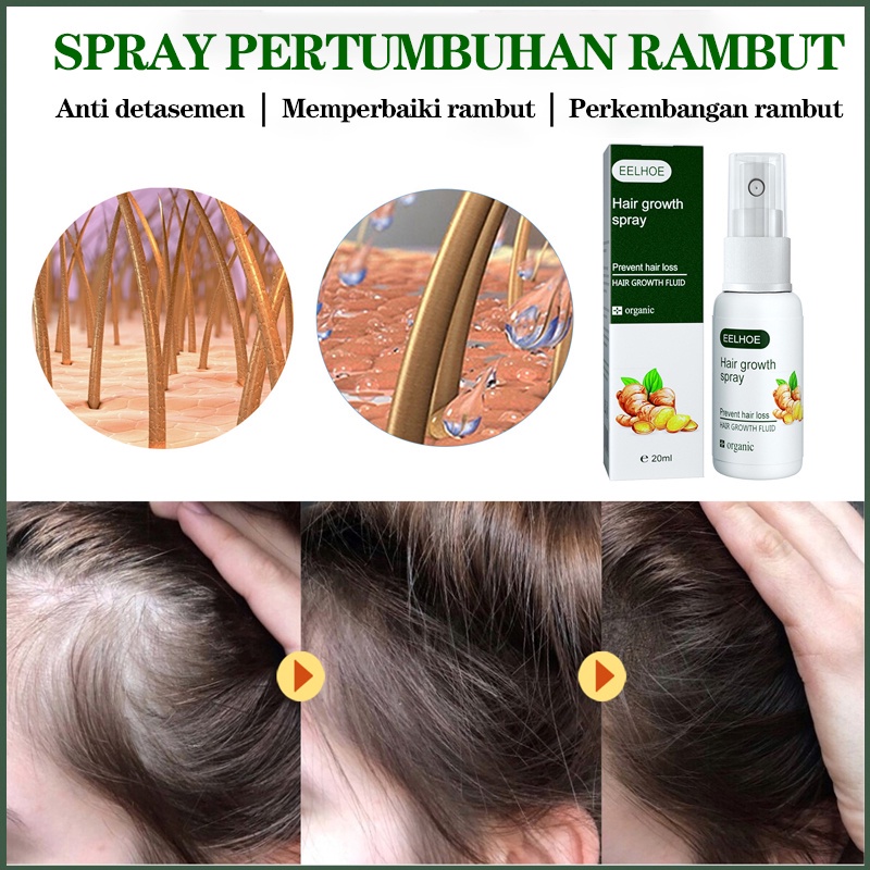 penumbuh rambut Hair growth serum penumbuh rambut botak serum penumbuh rambut 20ml serum rambut rontok Penumbuh Rambut Cepat