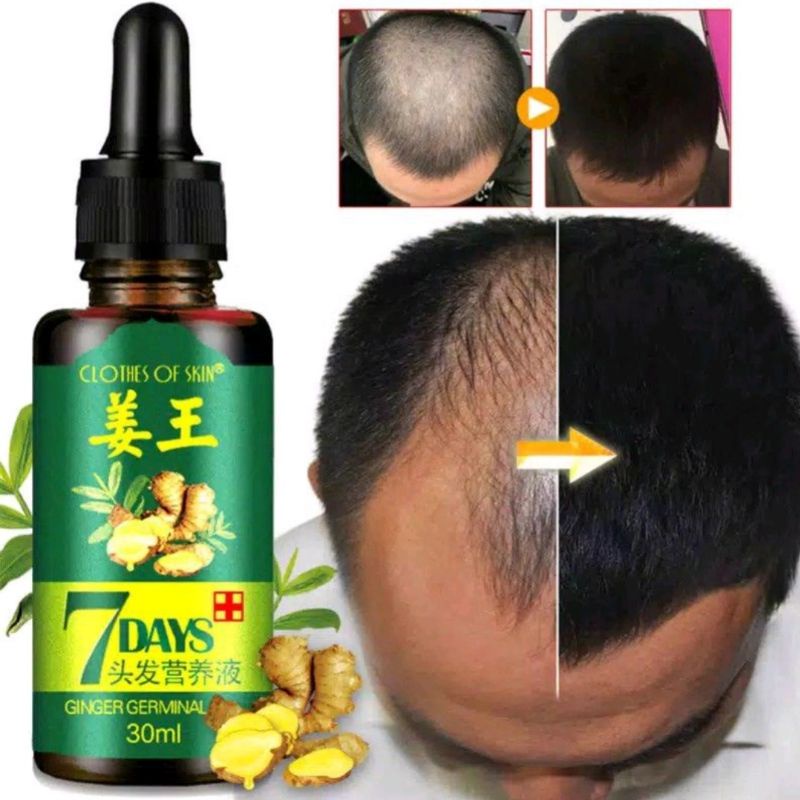 Clothes of Skin 7 Days Ginger Germinal Oil Minyak penumbuh dan perawatan Rambut Botak 30ml Penumbuh Rambut Botak