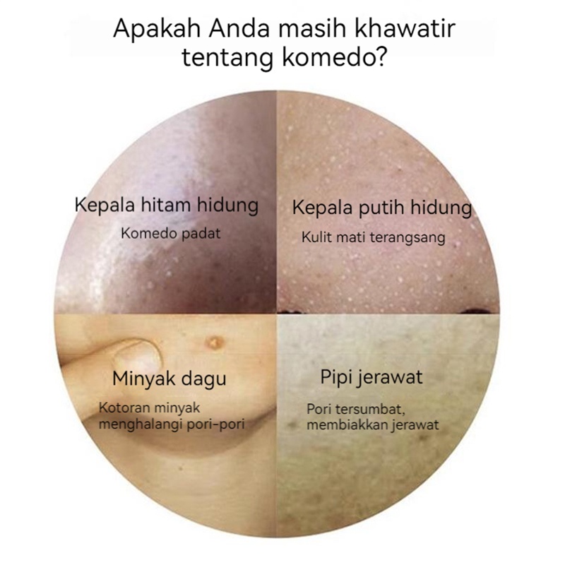 Alat Pembersih dan Penyedot Komedo / Blackhead Remover/Alat Penyedot Komedo Sedot Komedo Alat Penghilang Penyedot