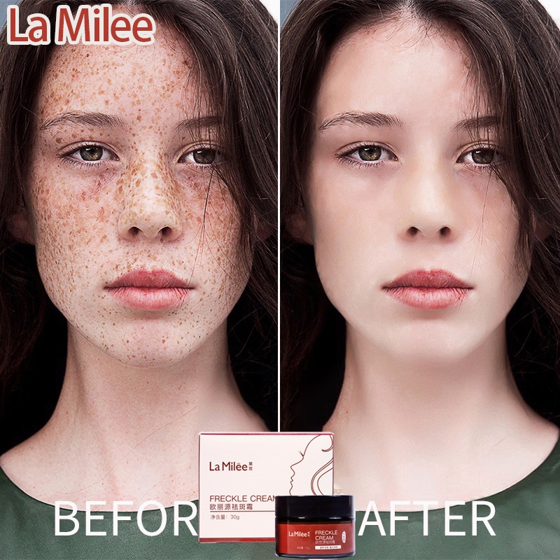 krim penghilang flek hitam cream penghilang flek hitam Penghilang flek hitam 30g serum penghilang fl