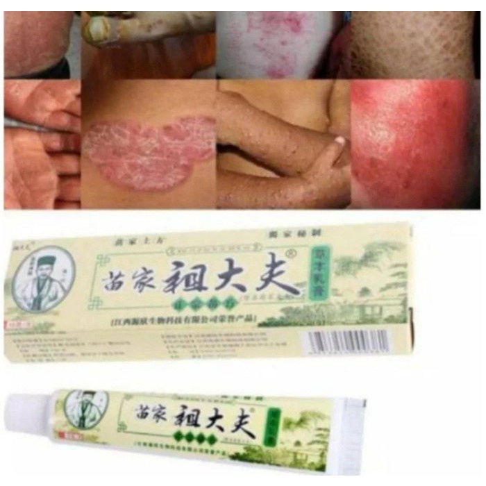 itching cream pereda gatal zudaifu krim hijau obat scabies kudis UPZme - 1 pcs