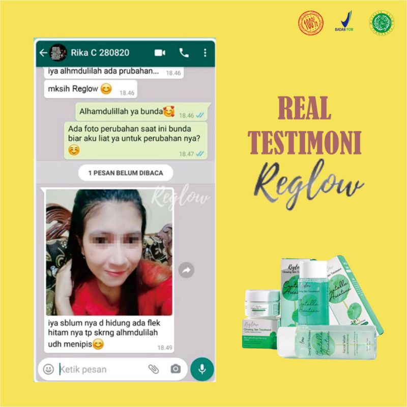 REGLOW SKINCARE ORIGINAL DR. SHINDY DOCTOR RE GLOW BEAUTY SKINCARE 100% BPOM UNTUK FLEK