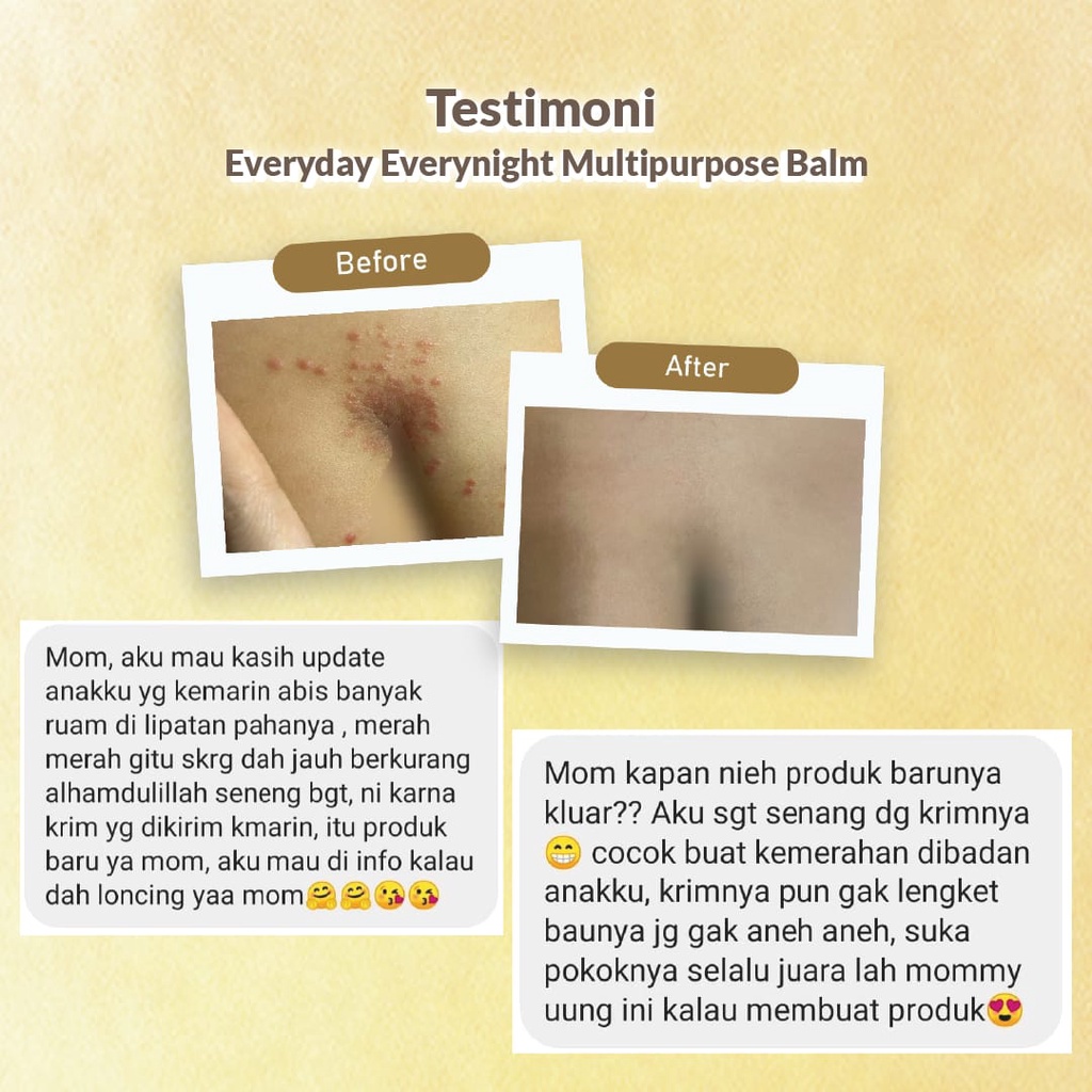 Moell Multipurpose Balm Everyday Everynight / Balm Bayi / Pelembaby baby / Skincare Baby