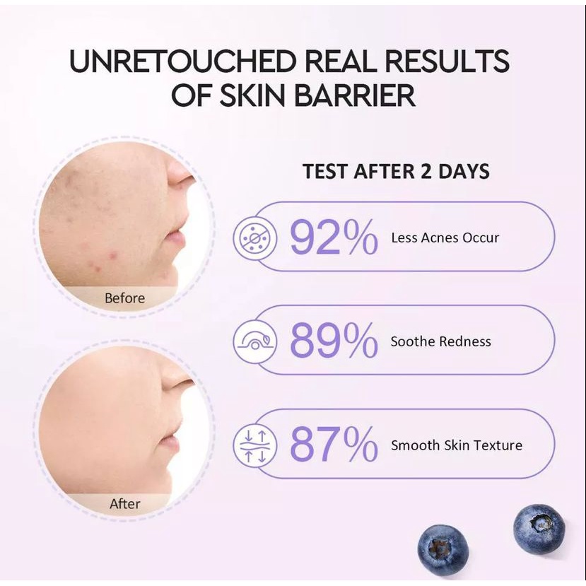 Glad2Glow 5% Blueberry Moisturizer Cream 5x Ceramide Skin Barrier Repair 25g