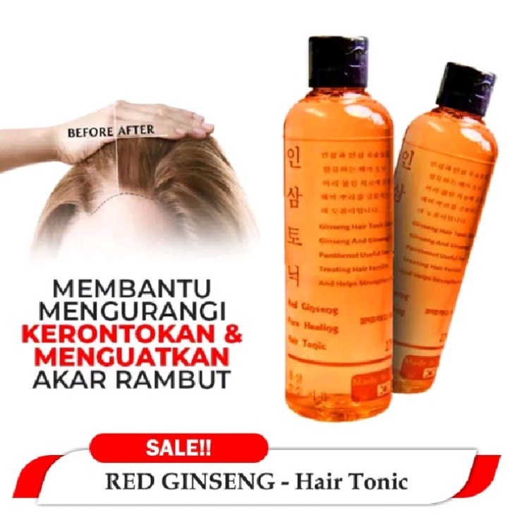 RED GINSENG HAIR TONIC ORIGINAL / Tonic Penumbuh Rambut dan Mencegah Kerontokkan