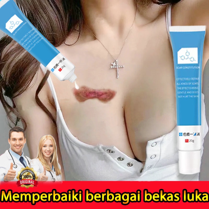 penghilang bekas luka-Cream Penghilang Bekas Luka-salep penghilang bekas luka-penghilang bekas koren