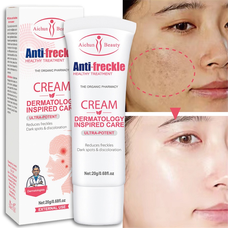 AICHUN Whitening Freckle Cream Remove Dark Spots Penghilang Flek/Jerawat/Bintik Noda Hitam Komedo-20Gr