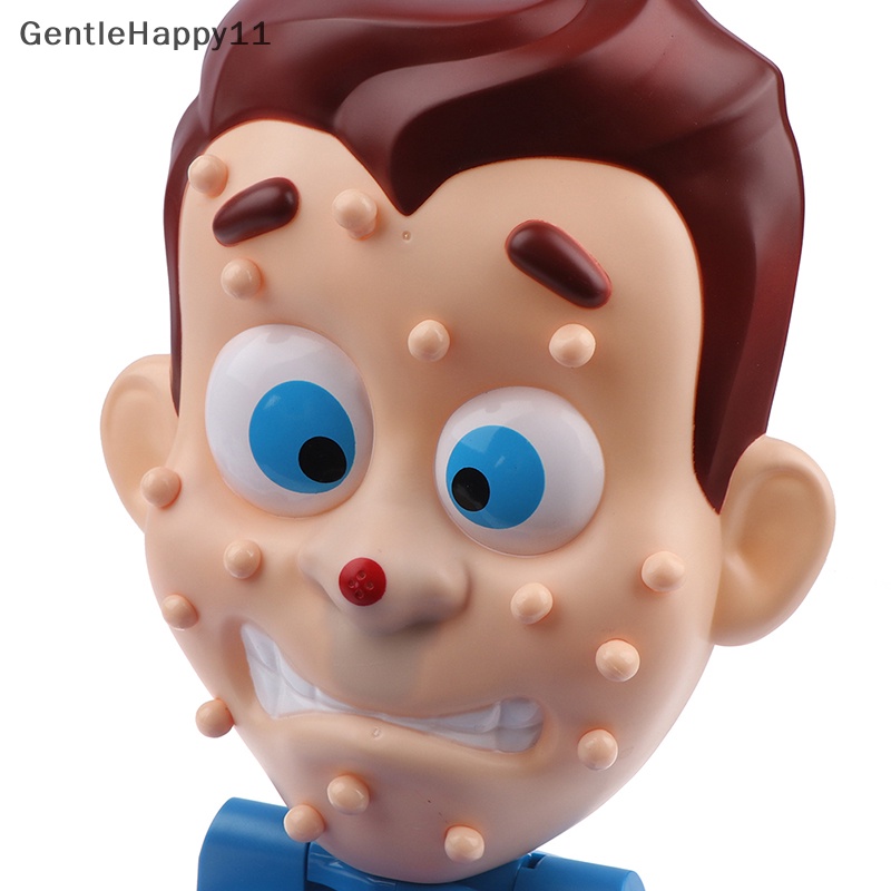 Gentlehappy Pencet Mainan Jerawat popping pimple pete Game Orang Tua-Anak Semprotan Air gags toy id