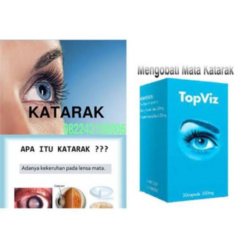 TopViz Obat Herbal Mata Katarak - Rabun Jauh & Dekat - Obat Minus & Plus Asli