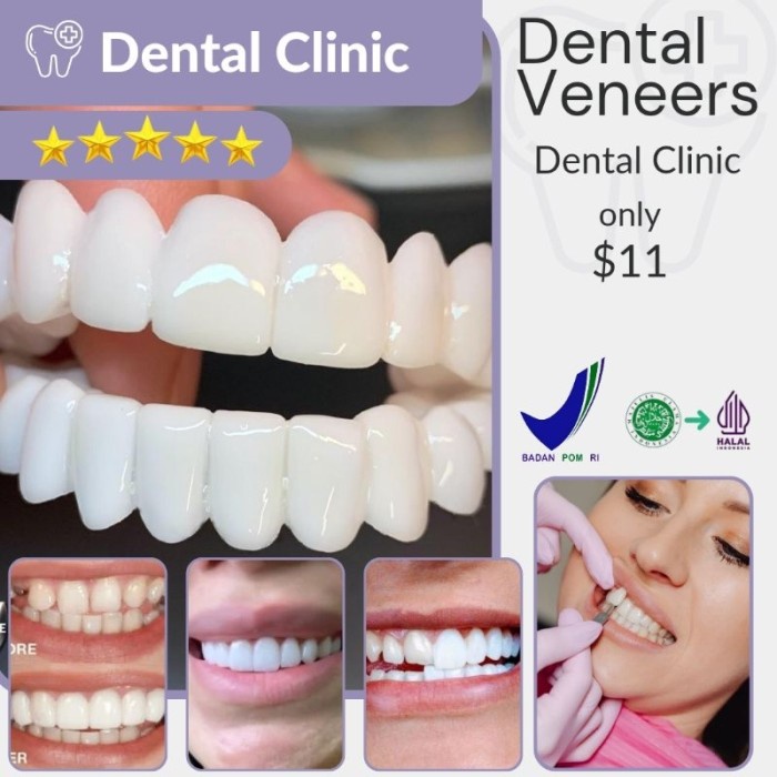 Snap on Smile Care Teeth Quality Veneer gigi berqualitas Limited