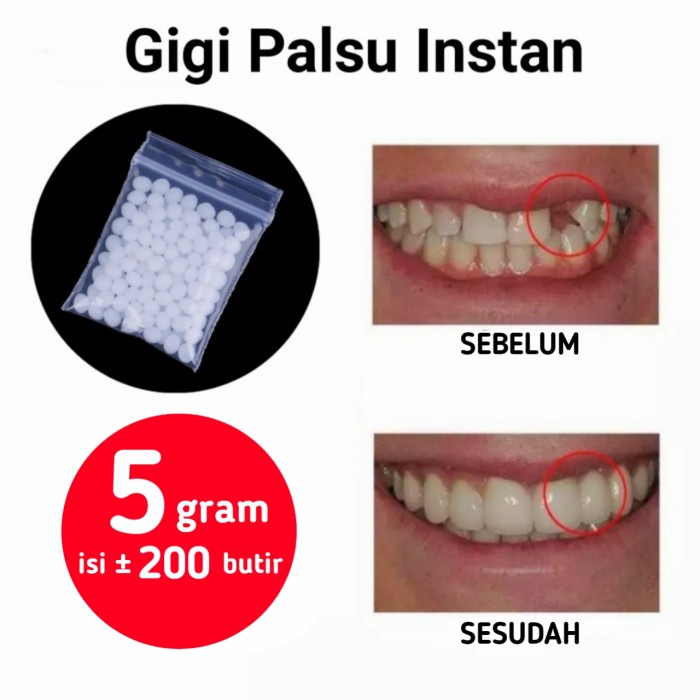 Gigi Palsu Instan Buat Sendiri Penambal Ompong Temptooth Temporary