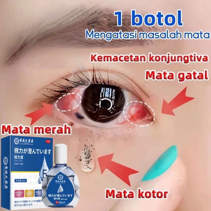 Obat tetes mata Tetes Mata Herbal Tetes Mata Alami Mengandung ekstrak blueberry Mata kering Sakit ma
