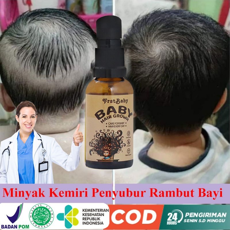 CAMBERUS_SHOP  Penumbuh Rambut Bayi & Anak minyak penumbuh rambut bayi 30ML penumbuh rambut bayi cep