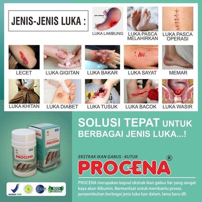 Kapsul Ekstrak Ikan Gabus Liar Procena Obat Herbal Untuk Bekas Luka