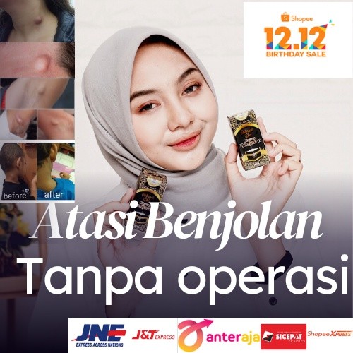 baahirah- benjolan dileher - obat benjolan - minyak oles baahirahori