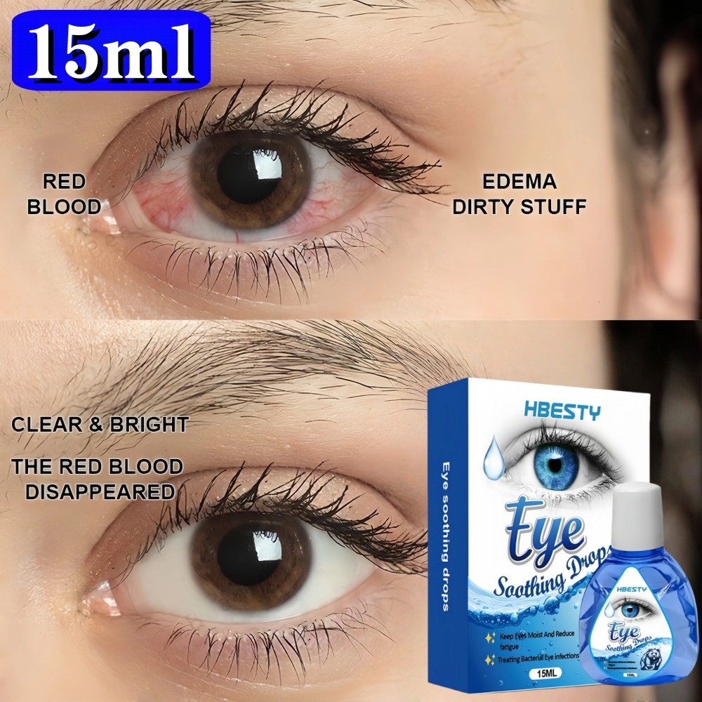 Obat Tetes Mata Obat Mata Katarak Eye Drop Obat Mata Buram Obat Mata Berlemak Tetes Mata Herbal Mata