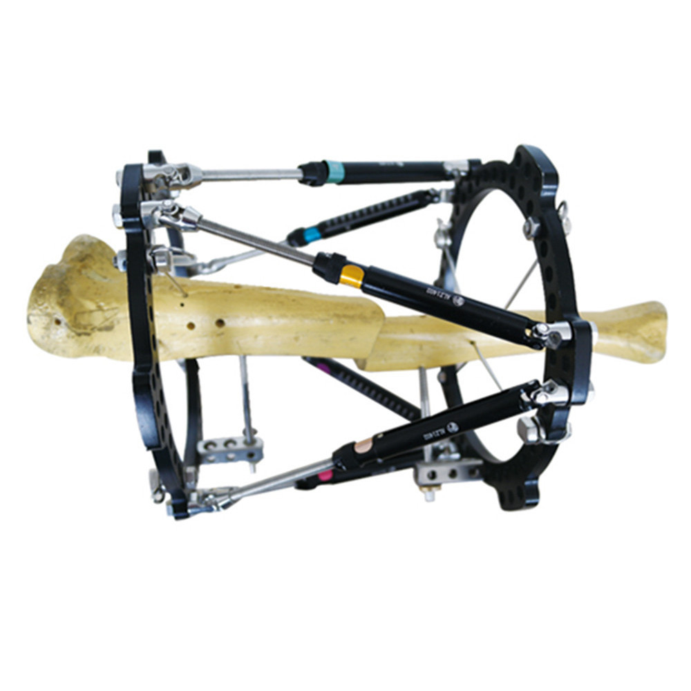 

The Taylor SPATIAL FRAME for External fixation