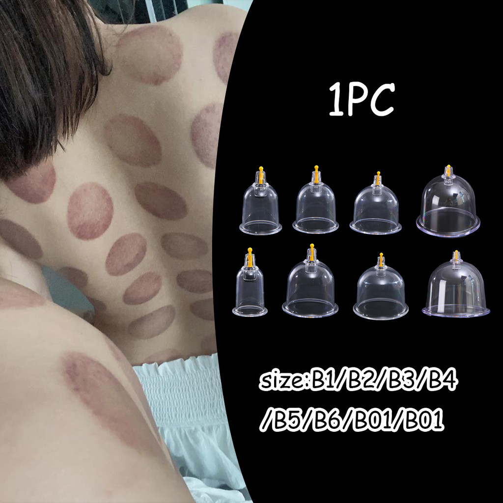 Gelas Bekam Alat Cupping Tuba Kop Angin Bekam Punggung Terapi Tradisional Masuk Angin Alat Kop Peraw