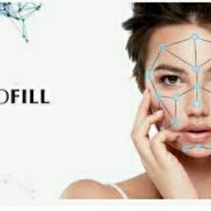 Nucleofill Strong Orinal