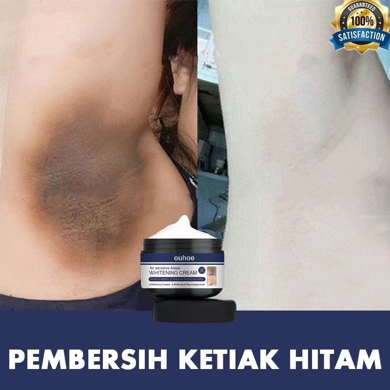 Pemutih miss v Pemutih selangkangan Memutihkan selangkangan hitam Pencerah selangkangan 30g Pemutih 