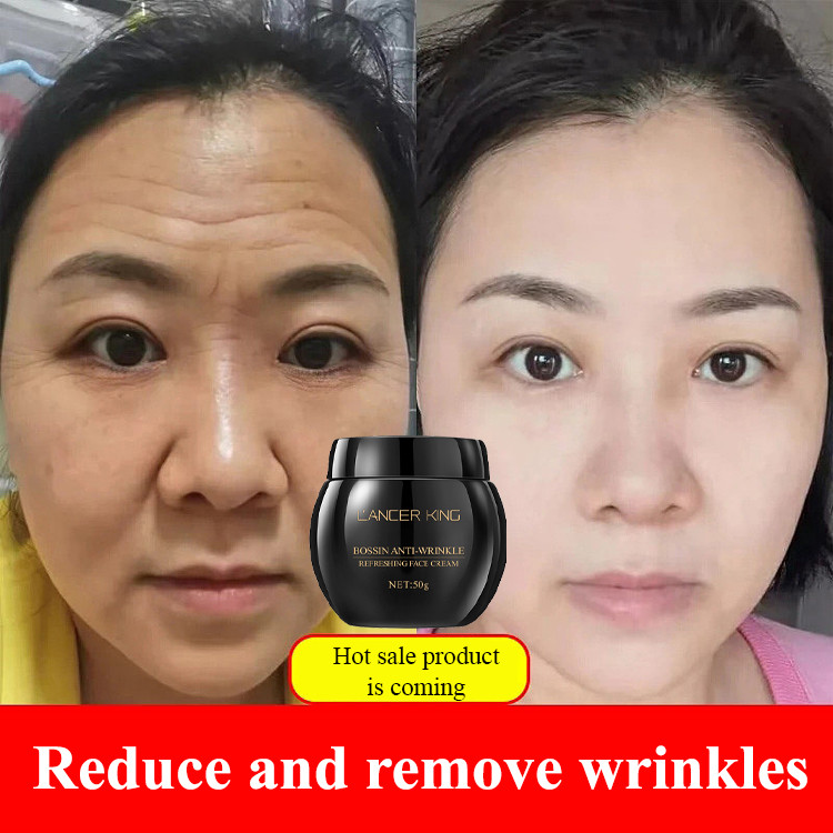 Black Bandage Bossin Whitening freckle removal cream