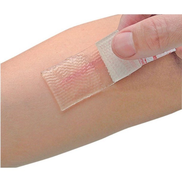 Cica-Care Silicone Gel untuk Keloid