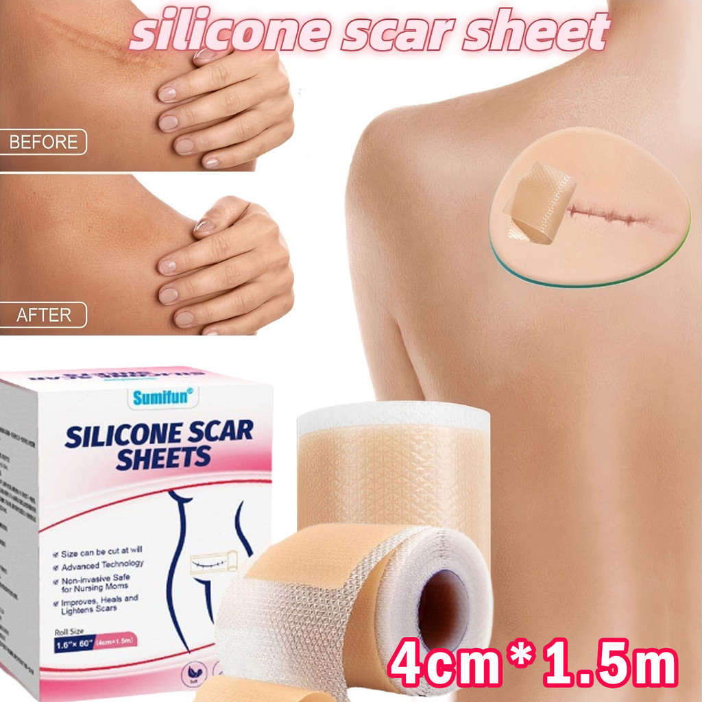 Sumifun 4*150cm Silicone Scar Sheet Gel silikon penghilang keloid bekas luka Plester Bekas Luka Meng