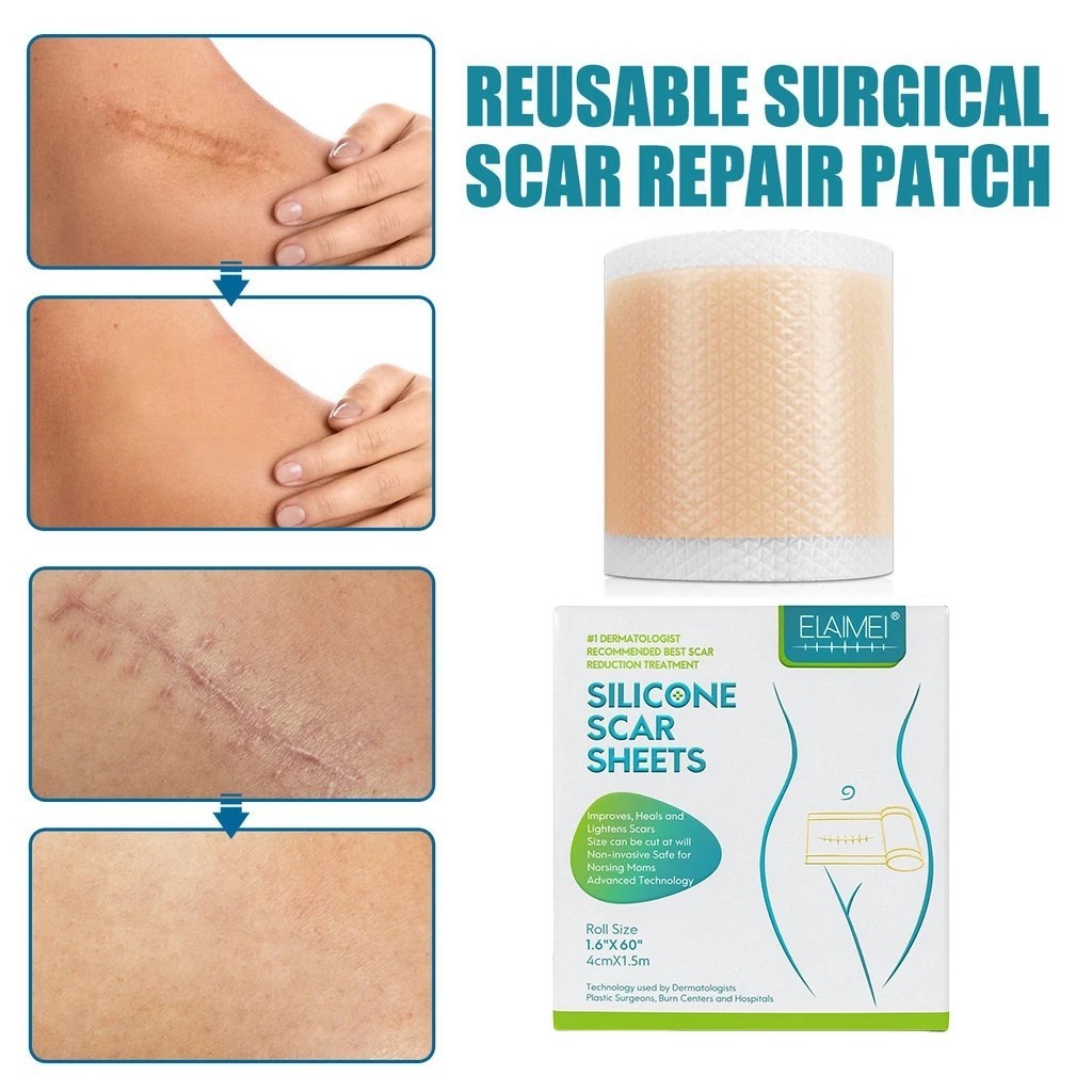 Silicone Scar Sheet plester silikon penghilang keloid bekas luka Silicon Keloid Plester Bekas Luka S