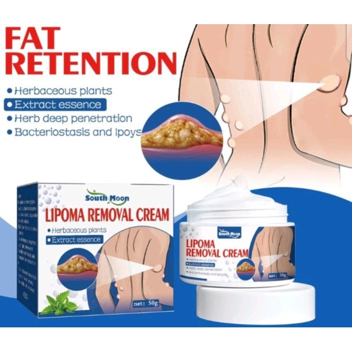 lipoma removal cream / lipoma remover krim lipoma BEST QUALITY | IFN