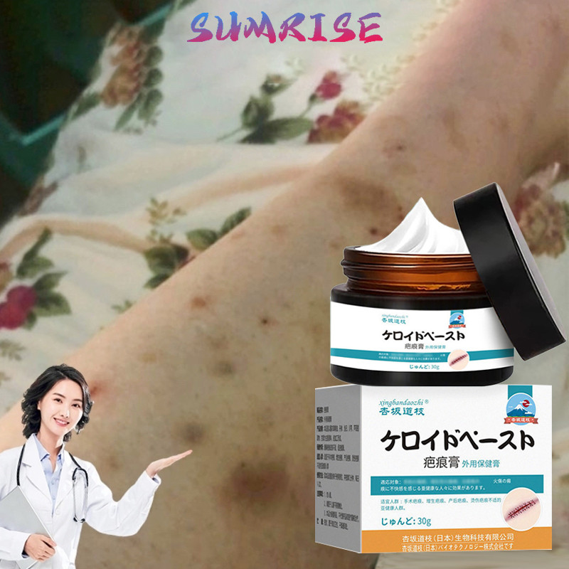 Penghilang Bekas Luka Hitam Koreng Salep Penghilang Bekas Luka Obat Penghilang Bekas Luka Menghilang