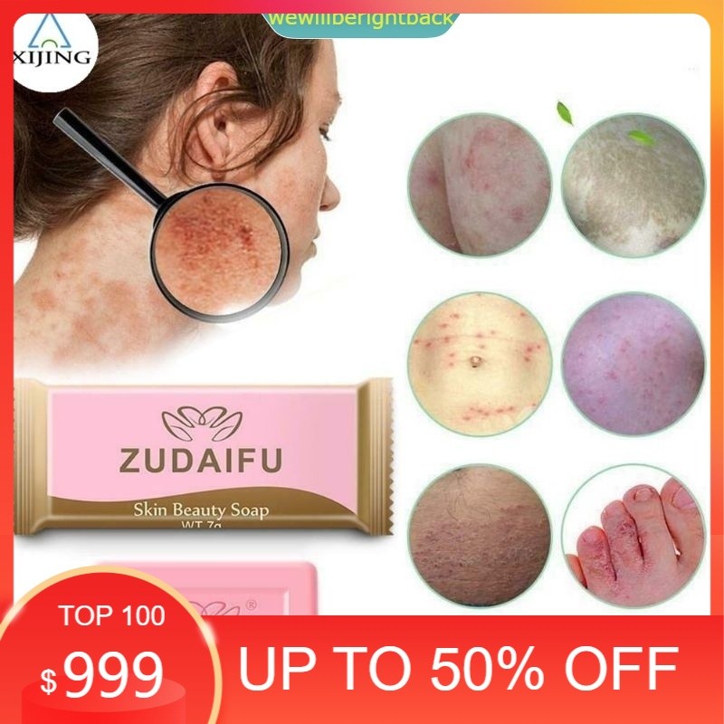 sale Yiganerjing Sabun Sulfur penyakit eksim anti bakteri psoriasis dermatitis kudis kurap panu jamu