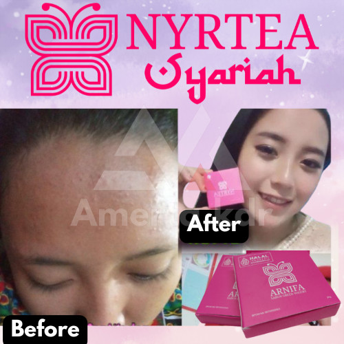 Amerta.kdr - ORIGINAL SABUN GREEN YOGURD ARNIFA BY NYRTEA 100% Ori