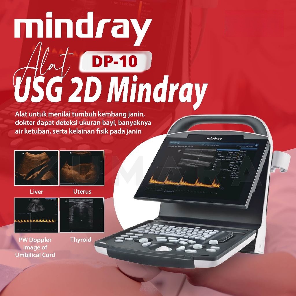 MINDRAY Alat USG 2D DP-10 with Doppler & Probe Ultrasound Klinik Rumah Sakit Manusia & Hewan DP10
